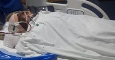 Ali Waseem, 30, of Addu atoll Meedhoo island: he had received the most severe injuries in the accident. PHOTO/SOCIAL MEDIA