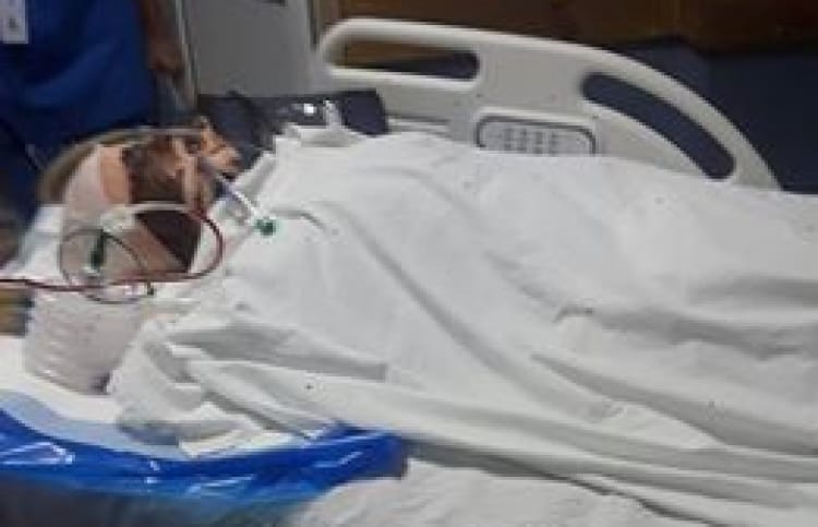 Ali Waseem, 30, of Addu atoll Meedhoo island: he had received the most severe injuries in the accident. PHOTO/SOCIAL MEDIA